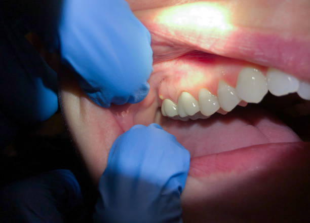 Best Holiday Emergency Dentist in Brookridge, FL